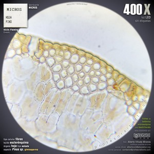 Esclerénquima: Fibras